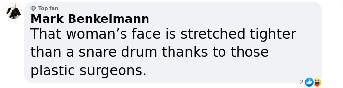 Comment on photo with text about a woman's appearance, referencing plastic surgeons. Comment on photo with text about a woman's appearance, referencing plastic surgeons.