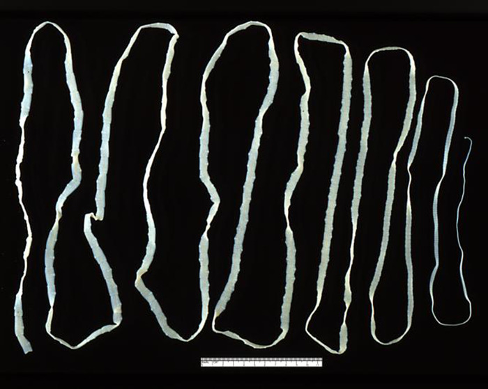 Tapeworm extracted from a woman's body displayed on a black background. Tapeworm extracted from a woman's body displayed on a black background.