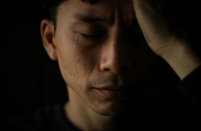 Man with eyes closed, showing burn scars on cheek, in a somber expression. Man with eyes closed, showing burn scars on cheek, in a somber expression.