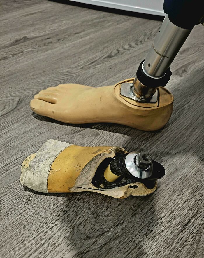 Prosthetic leg beside damaged foot, illustrating wear and time's impact on things.