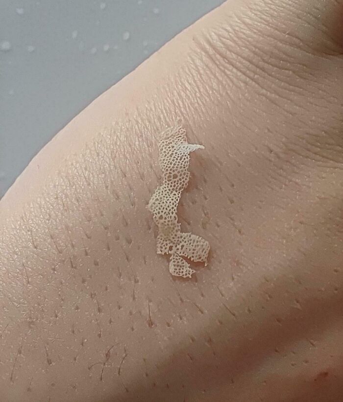 Close-up of skin with a peeling lace-like layer, highlighting the world's interesting textures.