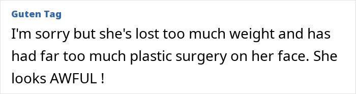 Comment on Tara Reid's appearance, discussing weight and plastic surgery. Comment on Tara Reid's appearance, discussing weight and plastic surgery.