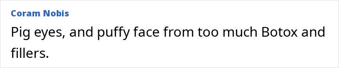 Comment on a celebrity's appearance, mentioning changes due to beauty treatments. Comment on a celebrity's appearance, mentioning changes due to beauty treatments.