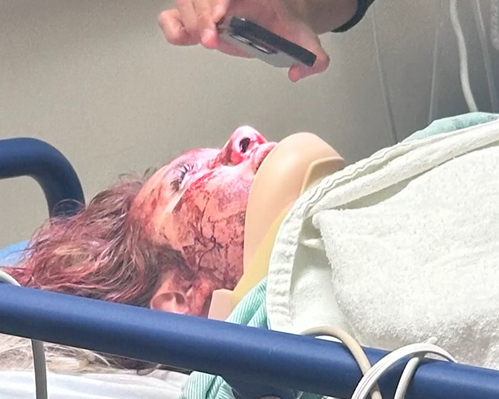 Injured bride-to-be in hospital bed, recovering from bachelorette party assault. Injured bride-to-be in hospital bed, recovering from bachelorette party assault.