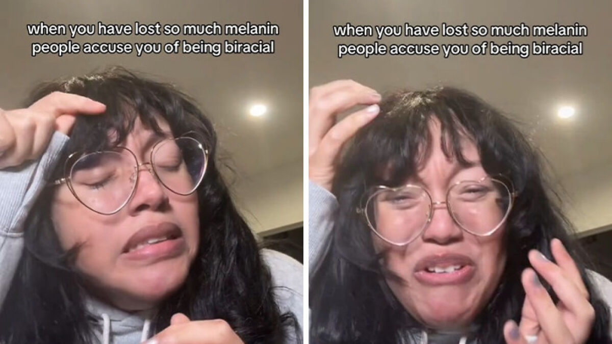 Black Woman With Stage 4 Cancer Films Melanin Loss That Has People Calling Her ‘Biracial’