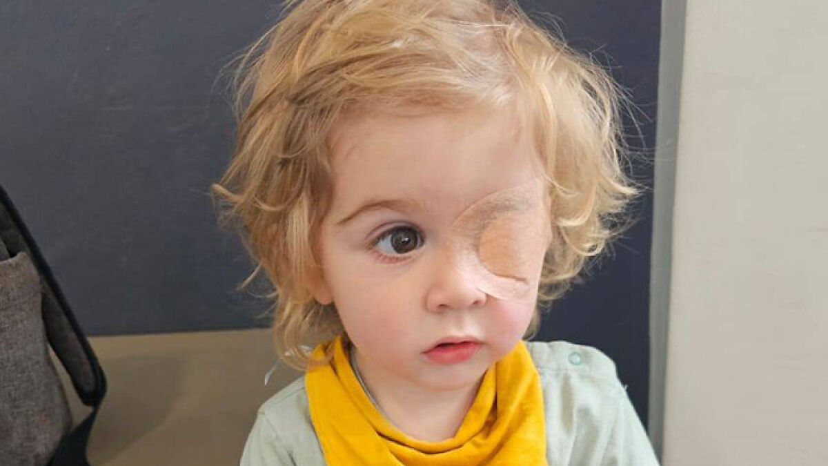 “Horrific!”: Toddler At Risk Of Losing His Eye After Being Kissed By Someone With Herpes Virus