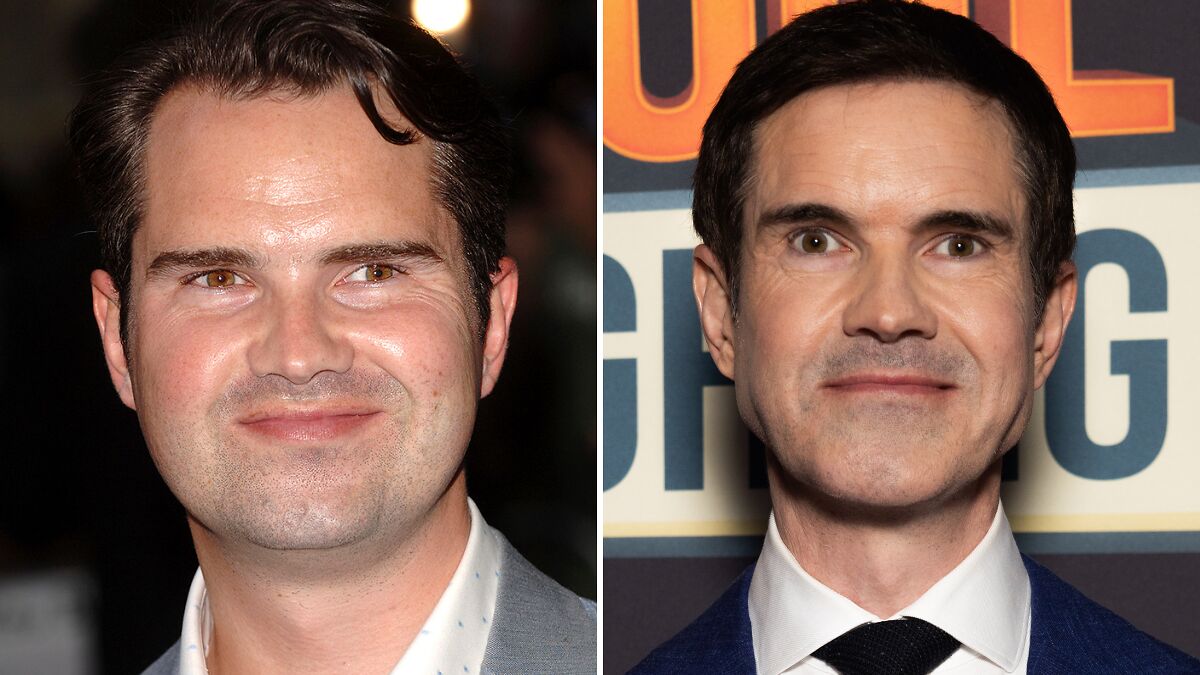 “He’s Aged 20 Years”: Jimmy Carr Admits He Can’t Stop Getting Cosmetic “Tweakments”