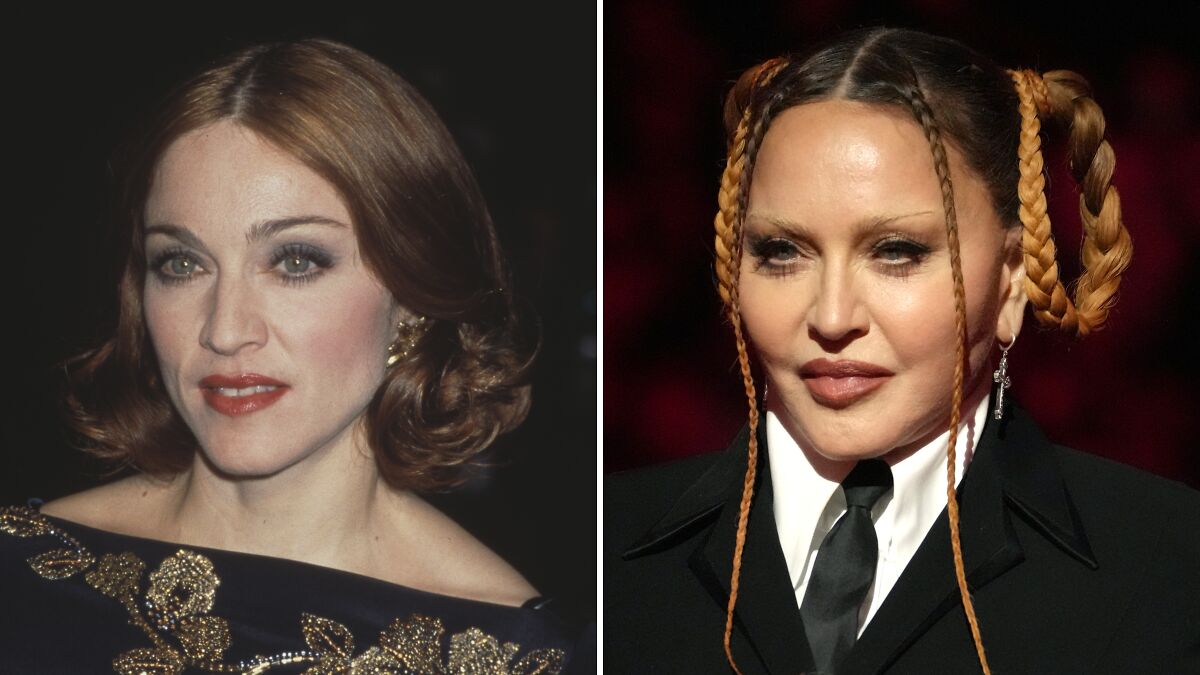 Going Under The Knife Has Had Some Brutal Effects On These 23 Celebrities