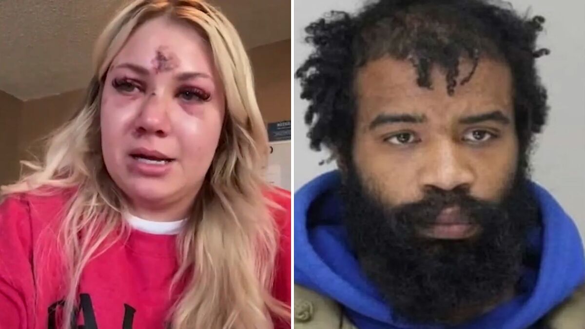 “I’m Shocked They Found Him”: Man Who Attacked Bride-To-Be At Bachelorette Party Arrested