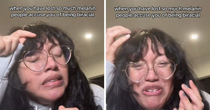 Black Woman With Stage 4 Cancer Films Melanin Loss That Has People Calling Her ‘Biracial’