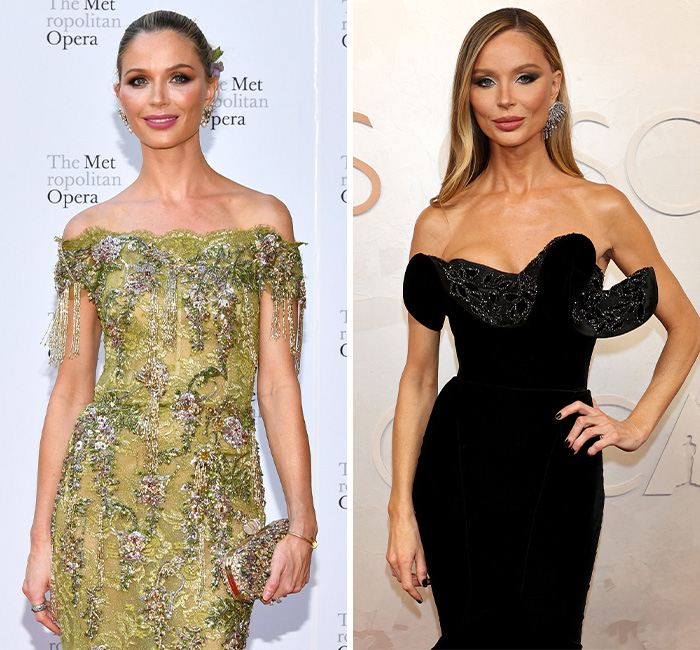 Two women at the 2025 Oscars, showcasing weight loss; one in a green gown, the other in black. Two women at the 2025 Oscars, showcasing weight loss; one in a green gown, the other in black.