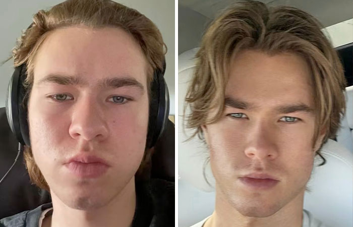 Vain man transforms with techniques, before and after photos show dramatic 'supermodel' change. Vain man transforms with techniques, before and after photos show dramatic 'supermodel' change.