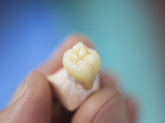 Close-up of a tooth model held between fingers, related to husband's prank. Close-up of a tooth model held between fingers, related to husband's prank.