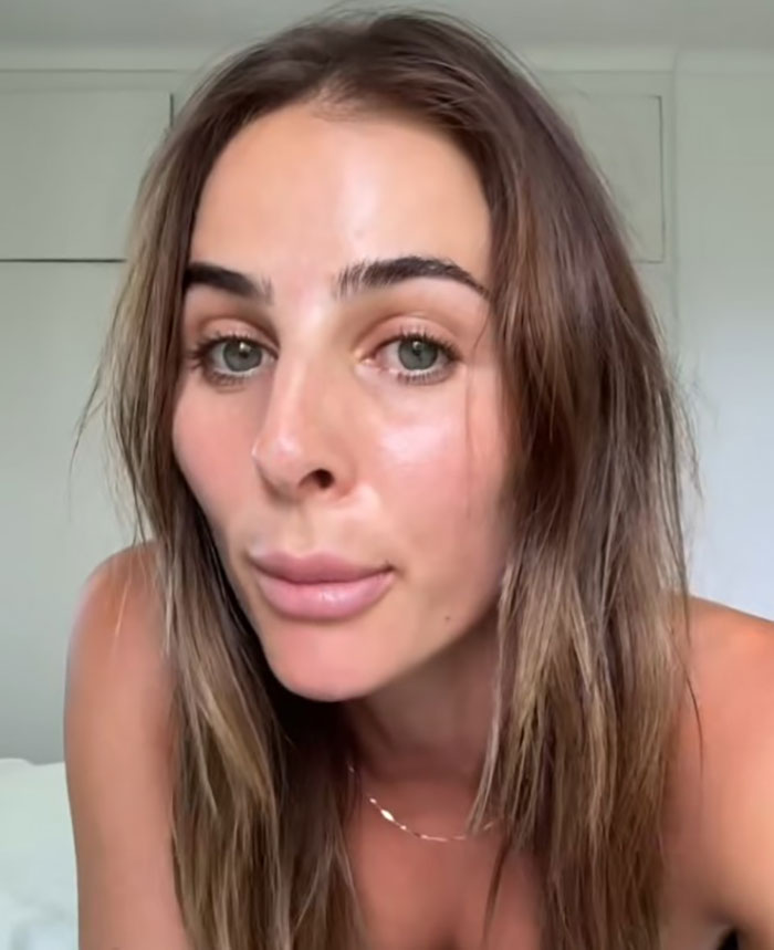 Woman showing rhinoplasty results with straight hair in a bright room. Woman showing rhinoplasty results with straight hair in a bright room.