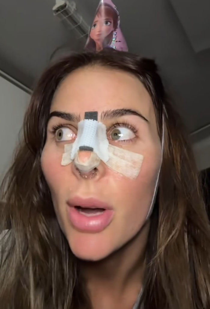 Woman with bandaged nose after rhinoplasty wearing a party hat indoors. Woman with bandaged nose after rhinoplasty wearing a party hat indoors.