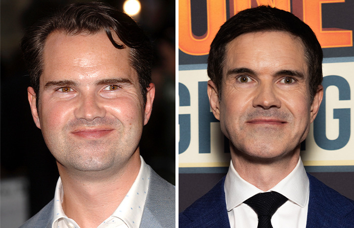 Comedian discusses cosmetic "tweakments" in side-by-side photos, showcasing changes over time. Comedian discusses cosmetic "tweakments" in side-by-side photos, showcasing changes over time.