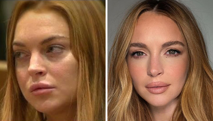 Lindsay Lohan in a before and after collage. Lindsay Lohan in a before and after collage.