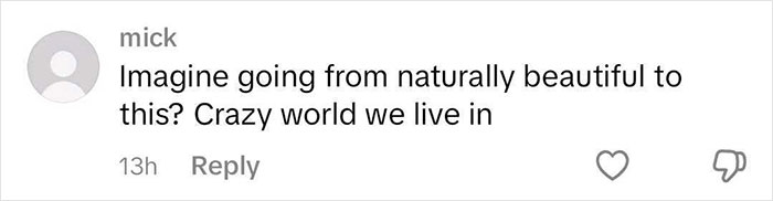 Comment criticizing rhinoplasty results, saying "Imagine going from naturally beautiful to this? Crazy world we live in. Comment criticizing rhinoplasty results, saying "Imagine going from naturally beautiful to this? Crazy world we live in.
