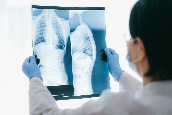 Hospital worker examining chest X-rays, highlighting patients' regrets and medical insights.