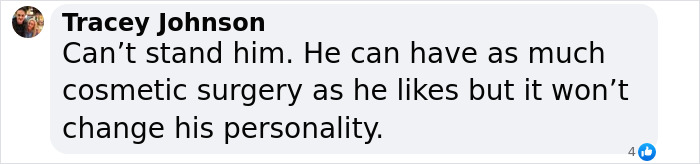 Comment criticizing Jimmy Carr's cosmetic surgery decisions. Comment criticizing Jimmy Carr's cosmetic surgery decisions.