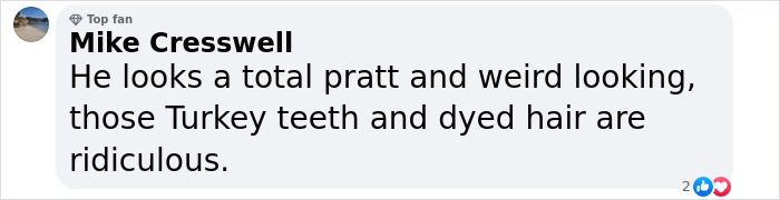 Comment criticizing cosmetic choices, mentioning Turkey teeth and dyed hair. Comment criticizing cosmetic choices, mentioning Turkey teeth and dyed hair.