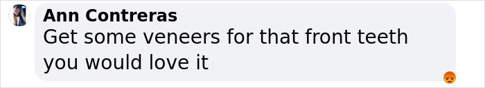 Comment screenshot suggesting veneers for front teeth, related to Aimee Lou Wood. Comment screenshot suggesting veneers for front teeth, related to Aimee Lou Wood.
