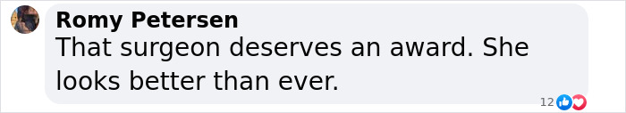 Social media comment about someone looking better than ever after surgery. Social media comment about someone looking better than ever after surgery.
