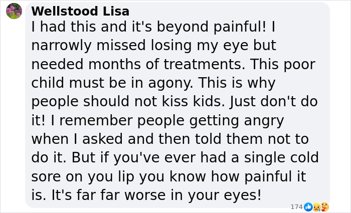 Commentary on herpes risks for children shared by a concerned user. Commentary on herpes risks for children shared by a concerned user.