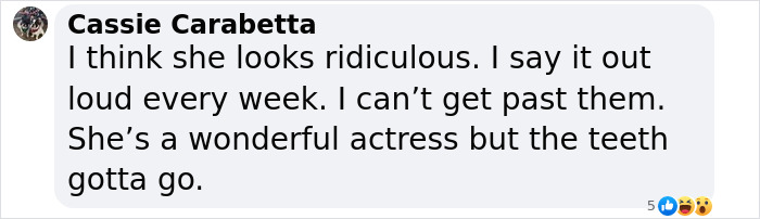 Social media comment criticizing Aimee Lou Wood's teeth, calling her "ridiculous" but acknowledging her acting talent. Social media comment criticizing Aimee Lou Wood's teeth, calling her "ridiculous" but acknowledging her acting talent.