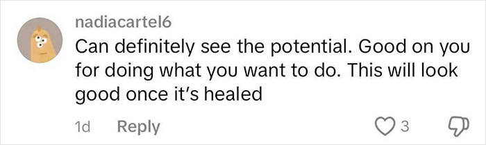 Social media comment supporting woman after rhinoplasty surgery. Social media comment supporting woman after rhinoplasty surgery.