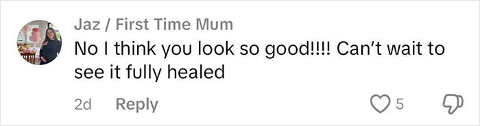 Comment expressing support after woman's rhinoplasty, saying she looks good and anticipating full healing. Comment expressing support after woman's rhinoplasty, saying she looks good and anticipating full healing.