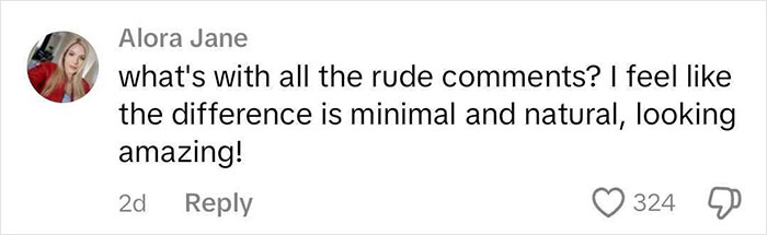 Comment supporting woman's rhinoplasty results amid online trolling. Comment supporting woman's rhinoplasty results amid online trolling.