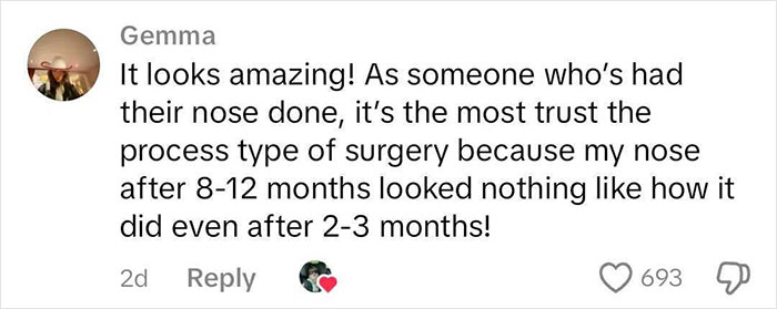 Comment defending rhinoplasty results, mentioning transformation over time and personal experience. 693 likes. Comment defending rhinoplasty results, mentioning transformation over time and personal experience. 693 likes.