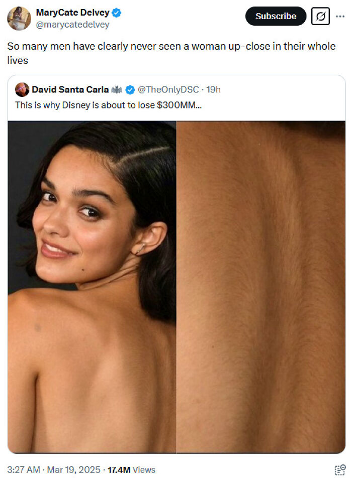 Woman confidently turns head, showcasing natural beauty and back hair, countering social media criticism. Woman confidently turns head, showcasing natural beauty and back hair, countering social media criticism.