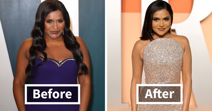 “Turning Into Cadavers”: A-Listers’ “Extreme” Weight Loss Photos Spark Genuine Concern