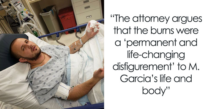 Man Suffers “Life-Changing” Burns At Starbucks Drive-Thru, Settles For $50M