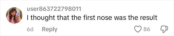 Social media comment discussing a botched nose job, showing surprise at the expected outcome. Social media comment discussing a botched nose job, showing surprise at the expected outcome.