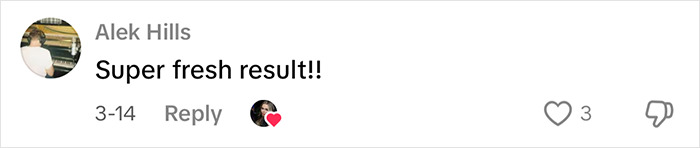 Comment by Alek Hills on eyelid surgery video, saying "Super fresh result!!" with a heart emoji response. Comment by Alek Hills on eyelid surgery video, saying "Super fresh result!!" with a heart emoji response.