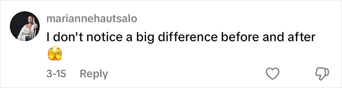 Comment on YouTube influencer's eyelid surgery video, noting no big difference, with a concerned emoji. Comment on YouTube influencer's eyelid surgery video, noting no big difference, with a concerned emoji.