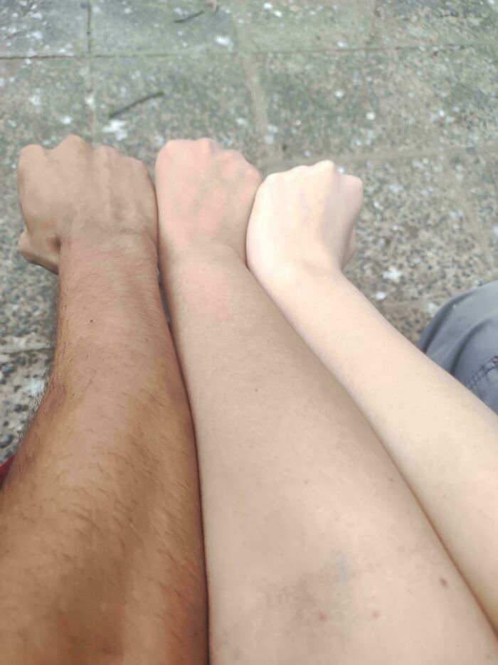 Three arms with different skin tones aligned together on a textured ground in an unremarkable photo that is strangely entertaining.