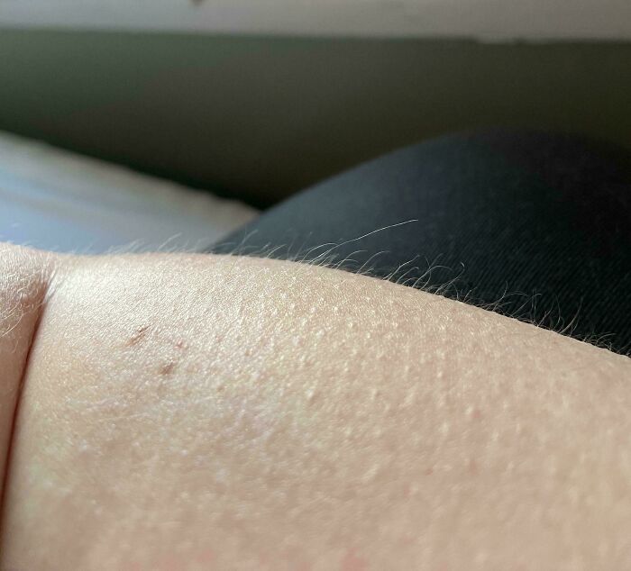 Close-up of skin with goosebumps and fine hairs, an unremarkable photo surprisingly entertaining to view.