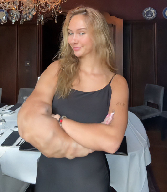 Woman confidently smiling with one arm larger than the other, standing in an elegant dining room. Woman confidently smiling with one arm larger than the other, standing in an elegant dining room.