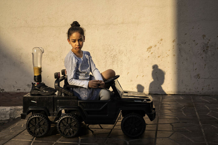 Girl in a toy car with a prosthetic leg beside her, capturing a moment at Istanbul Photo Awards 2025.