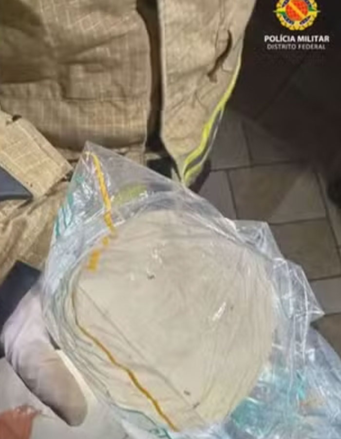 Police evidence showing a breast implant removal incident in a plastic bag. Police evidence showing a breast implant removal incident in a plastic bag.