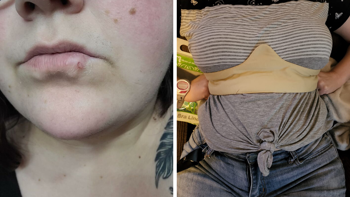 24 Mortifying Body Problems Nobody Wants To Talk About But Everyone Has