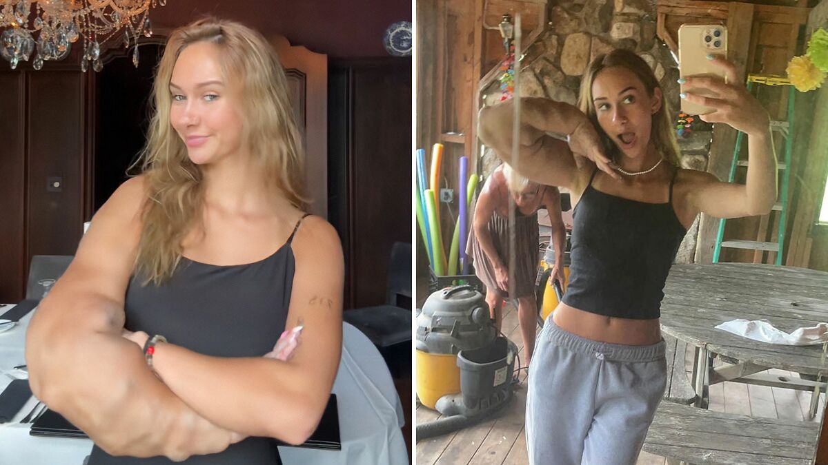 “I Always Explain”: Woman With One Arm Larger Than The Other Reveals Her Response To Stares