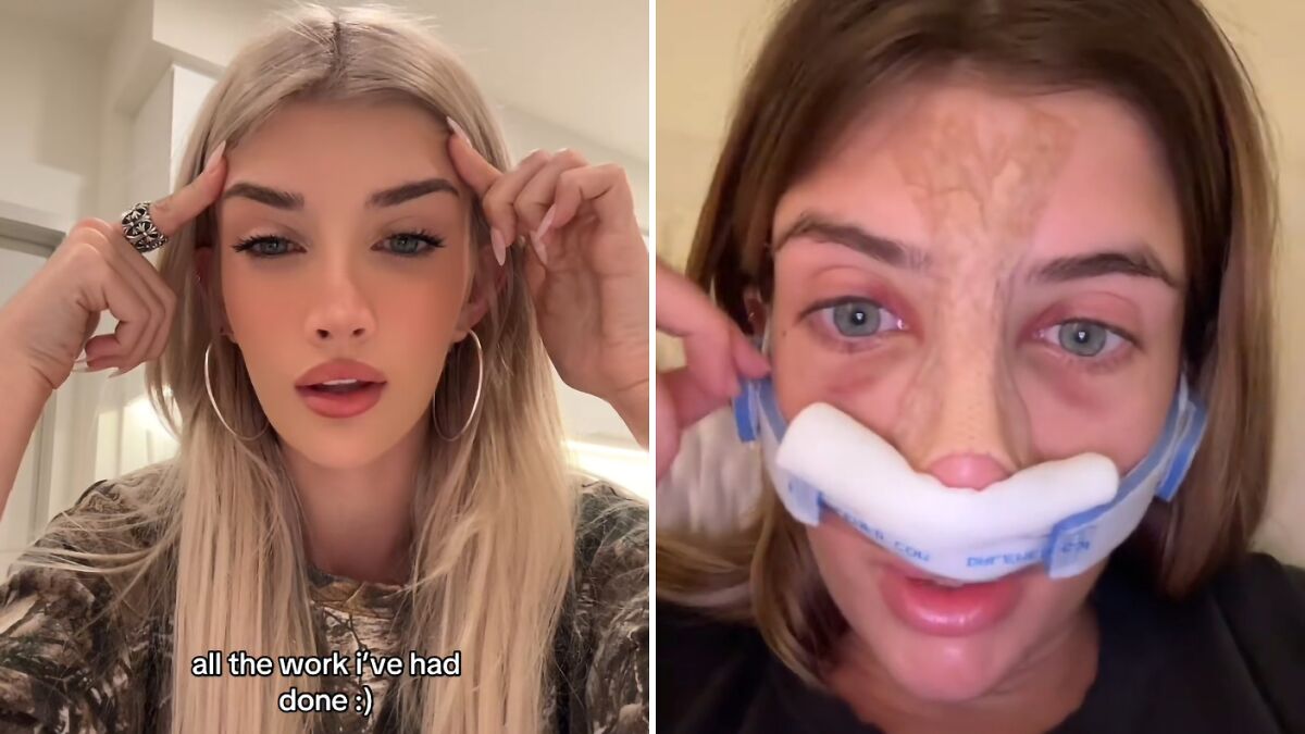 “Wish I Went Bigger”: Denise Richards’ Daughter Sami Sheen Reveals All Her Cosmetic Surgeries