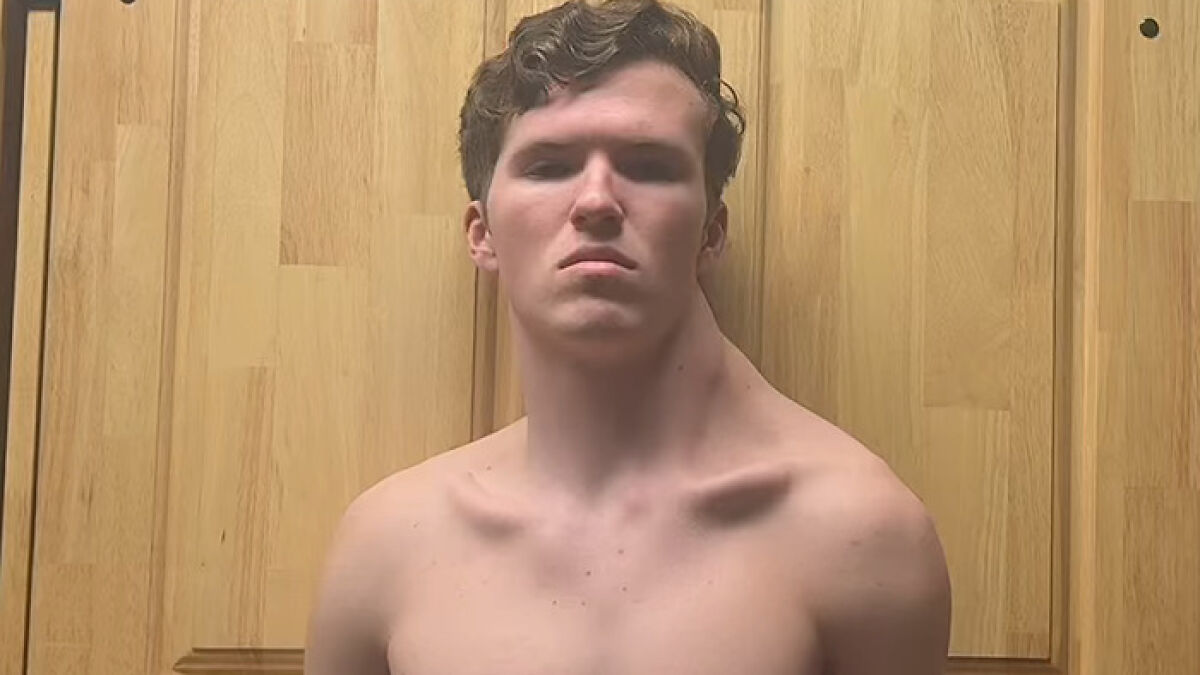 Viral Teen Only Trains One Side Of His Body, Claims It Helps Him Avoid Female Attention