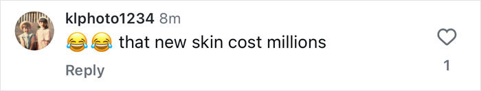 Comment on beauty and cost with laughing emojis, mentioning "new skin cost millions. Comment on beauty and cost with laughing emojis, mentioning "new skin cost millions.
