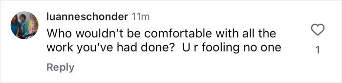 Instagram comment discussing beauty and plastic surgery, with a skeptical tone. Instagram comment discussing beauty and plastic surgery, with a skeptical tone.